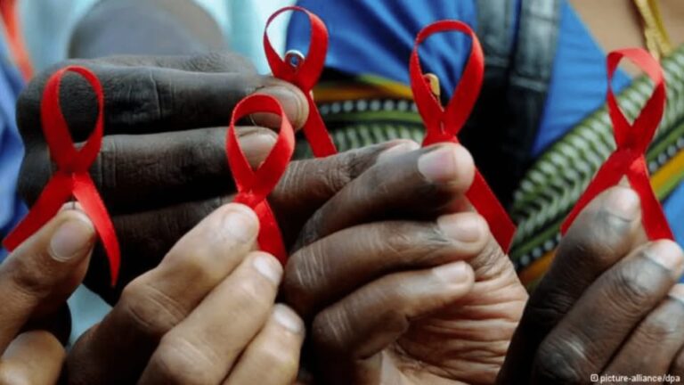 HIV